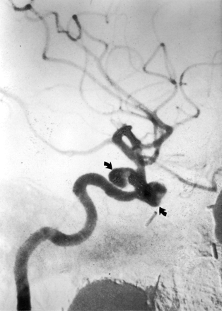 Fig 4.