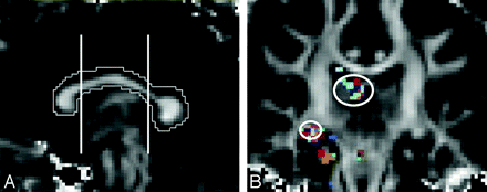 Fig 2.