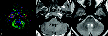 Fig 2.