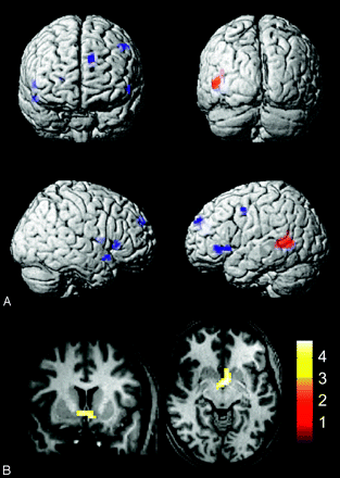 Fig 5.