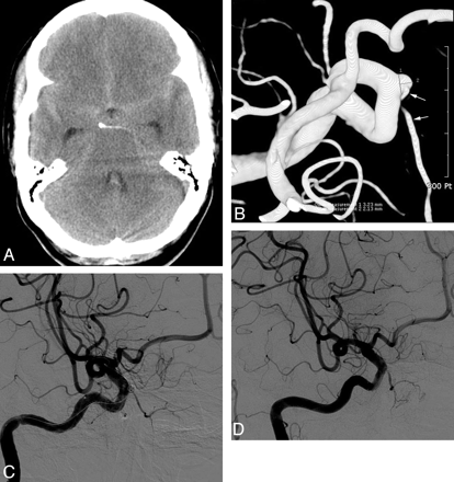 Fig 4.