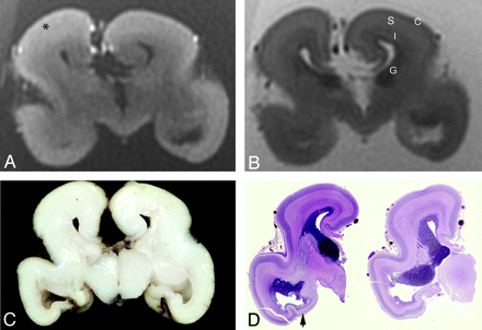Fig 2.
