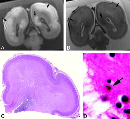 Fig 5.