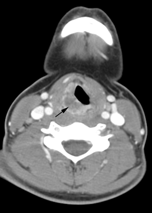Fig 2.
