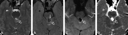 Fig 2.