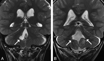Fig 4.