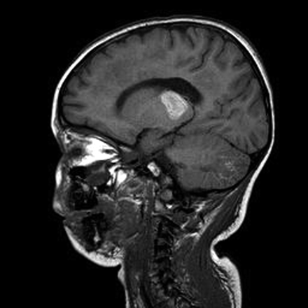 Fig 3.