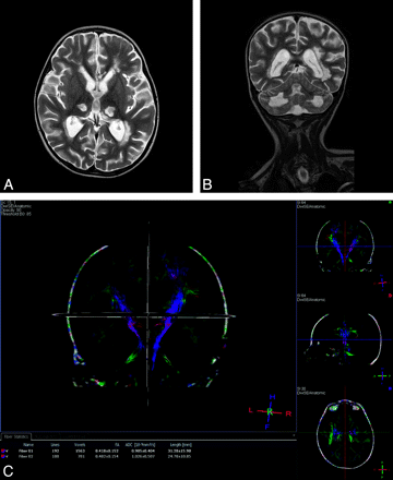Fig 4.