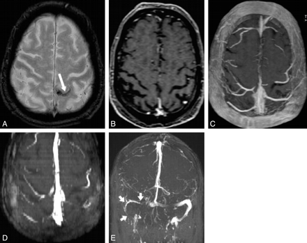Fig 3.