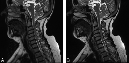 Fig 2.