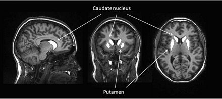 Fig 1.