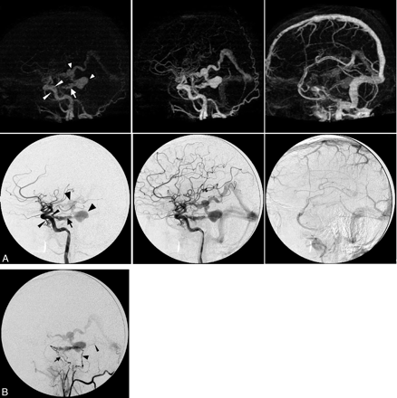 Fig 2.