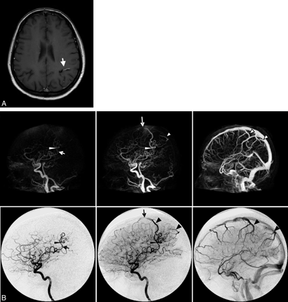 Fig 3.