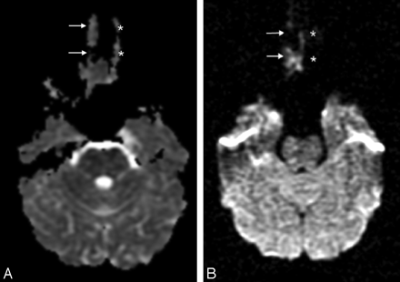 Fig 7.