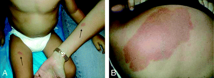 Fig 1.