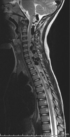 Fig 2.
