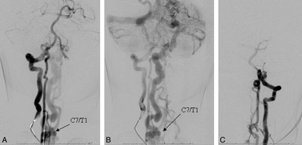 Fig 3.