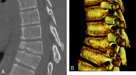 Fig 4.