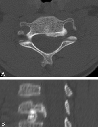 Fig 6.