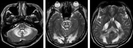 Fig 6.
