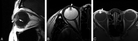 Fig 2.
