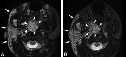 Fig 3.