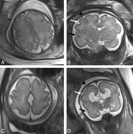Fig 4.