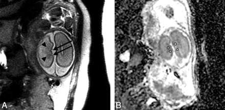 Fig 2.