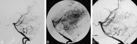 Fig 3.