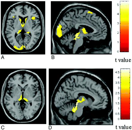 Fig 2.