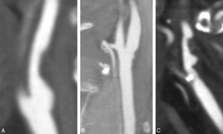 Fig 4.