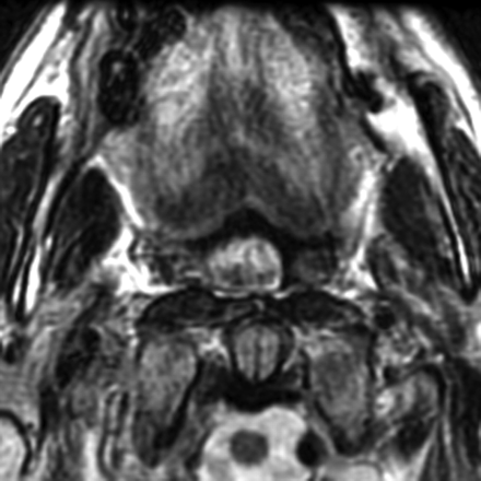 Fig 2.