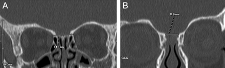 Fig 2.