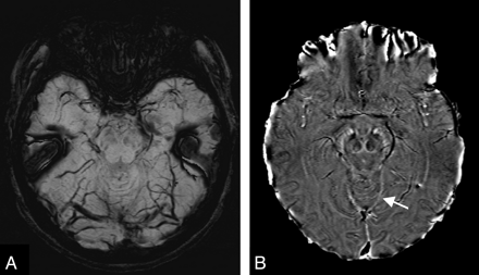 Fig 7.