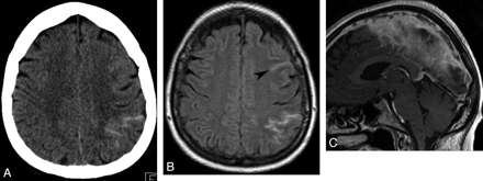 Fig 3.