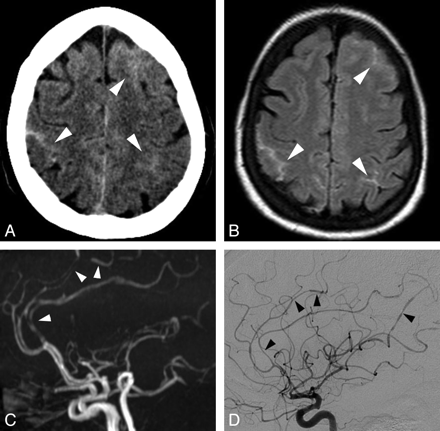 Fig 4.