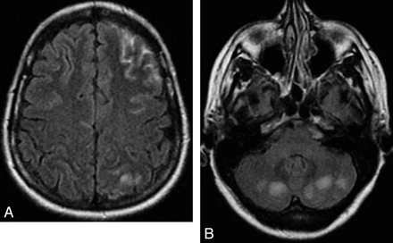 Fig 7.