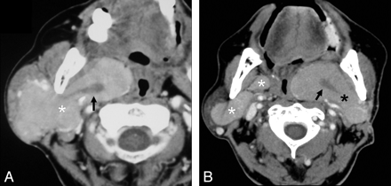 Fig 4.