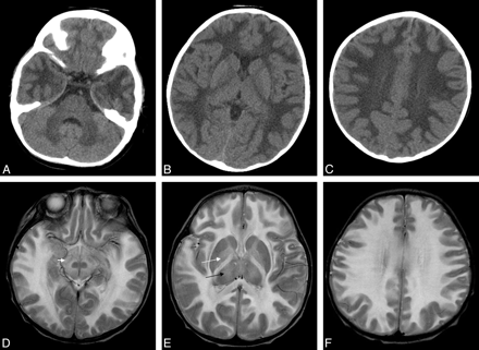 Fig 1.
