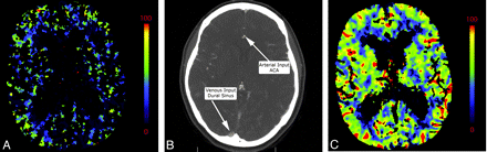 Fig 9.