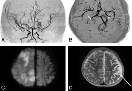 Fig 2.