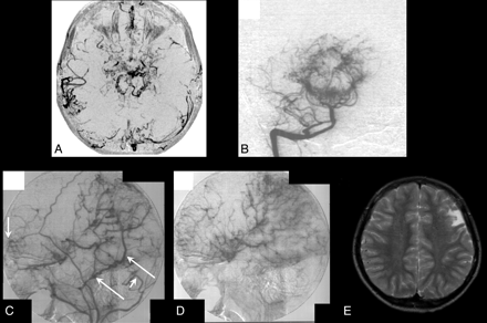 Fig 4.