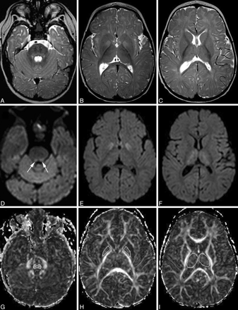 Fig 1.