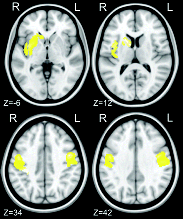 Fig 1.