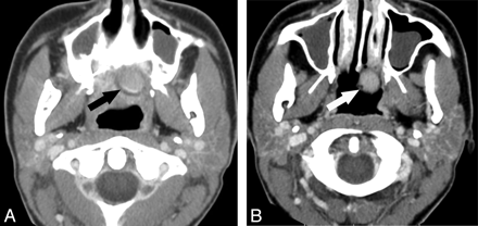 Fig 1.