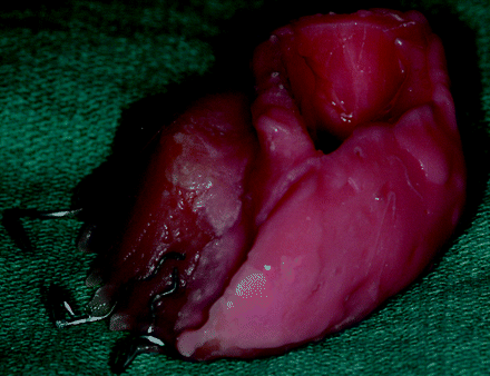 Fig 2.