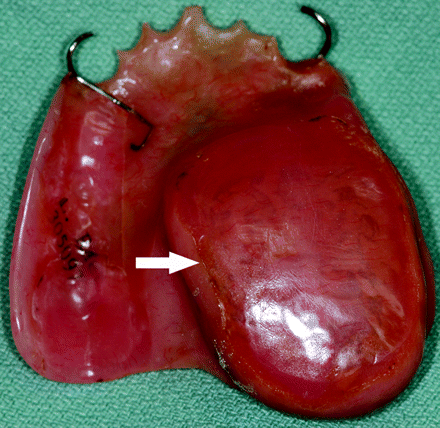Fig 5.