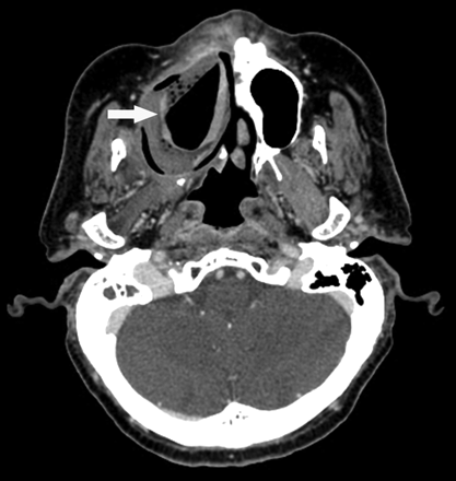 Fig 7.