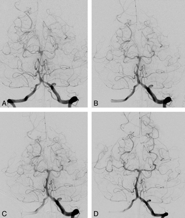 Fig 2.