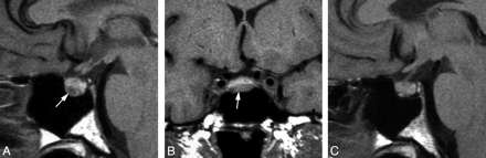 Fig 2.